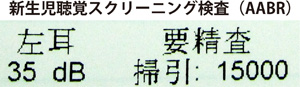 AABR自動聴性脳幹反応検査