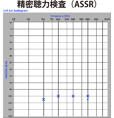 精密視力検査