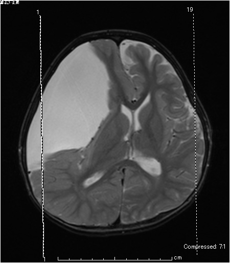 outpatients/img/post/nouge-18.jpg