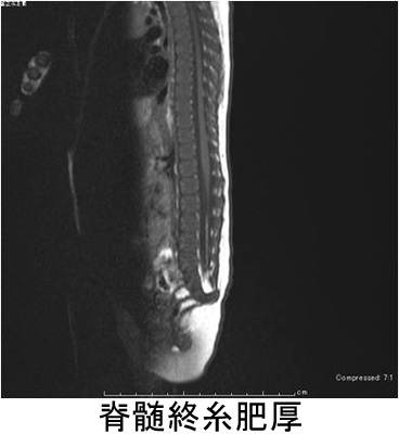outpatients/img/post/nouge10.jpg