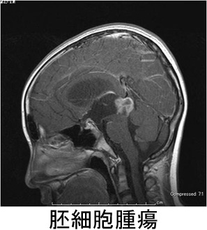 outpatients/img/post/nouge12.jpg