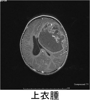 outpatients/img/post/nouge13.jpg