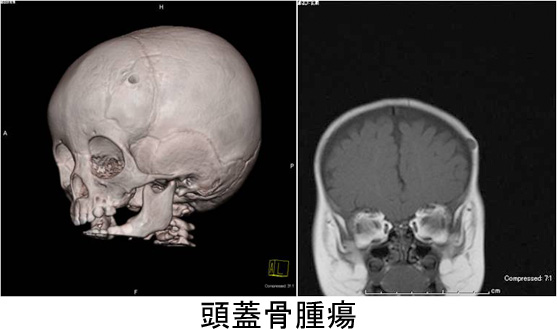 outpatients/img/post/nouge17.jpg