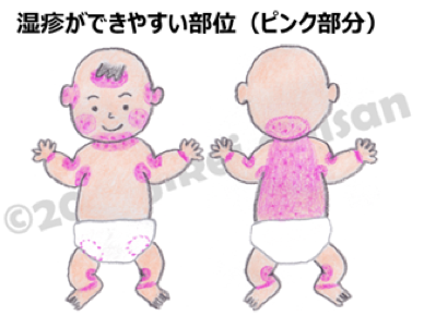イラスト