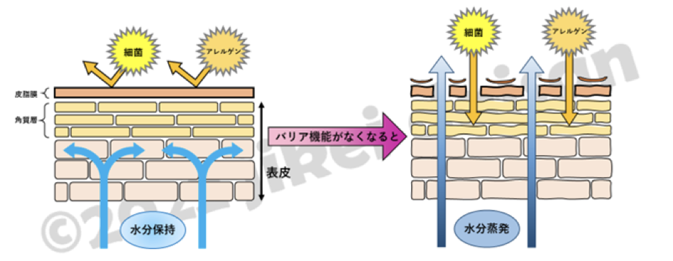 イラスト