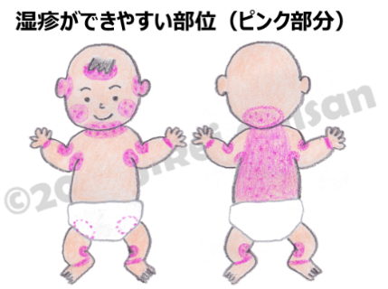 イラスト