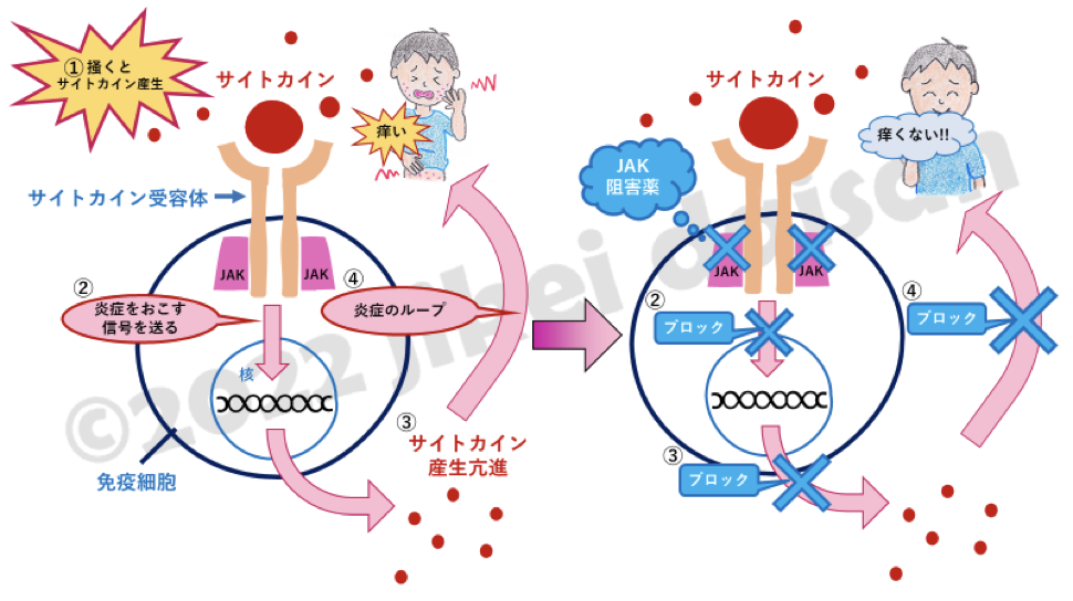 イラスト