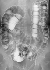 X��TV����