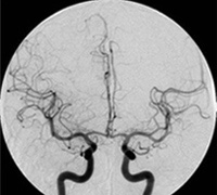 ��ɻ��Ƹ���