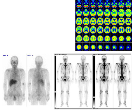 �˰�� �ʥ������ȡ��ס� ����