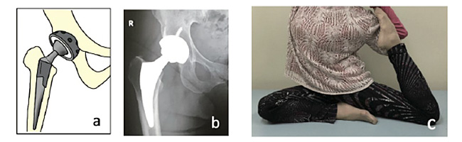 ��秲�¸�͹��Դ���