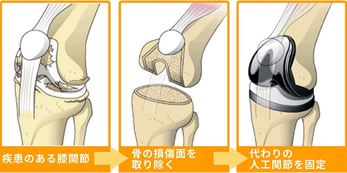 ���׹��ڤ��